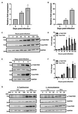 Protein Kinase R Restricts the Intracellular Survival of Mycobacterium tuberculosis by Promoting Selective Autophagy